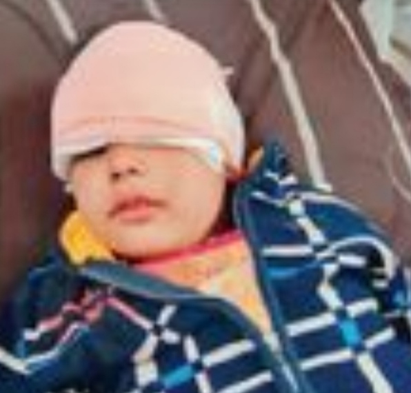 4-year-old girl in Preet Nagar of Jalandhar, cut with synthetic door, 15 stitches on her forehead