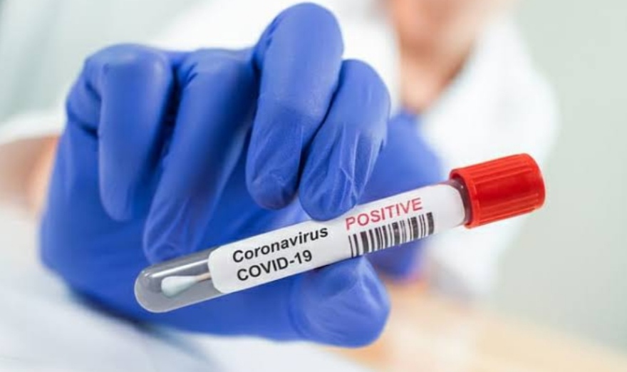 Central government issued advisory after the new variant of Corona JN.1 appeared