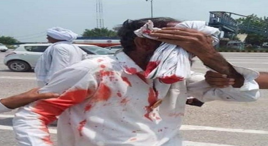 Police showered sticks on farmers, farmers shed blood, highways and toll jams across the state