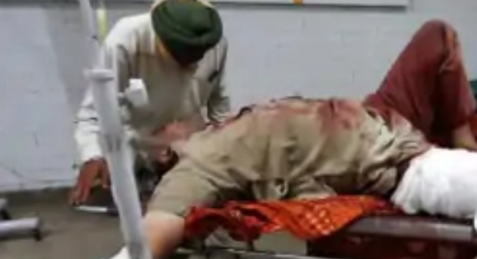 Shocking incident in Punjab, ASI cut challan and cut leg in return