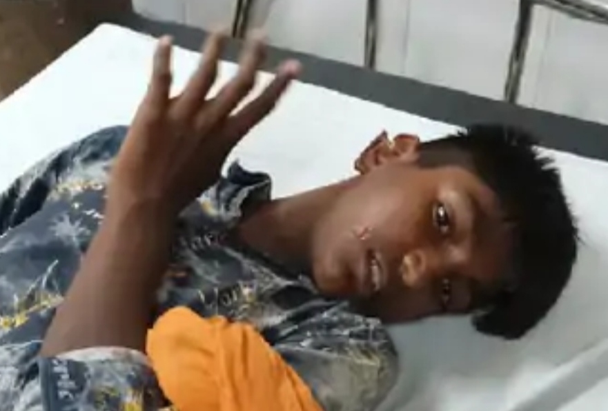 Pitbull dog attacked the teenager and plucked his ear, the father dared to rescue the son from his clutches