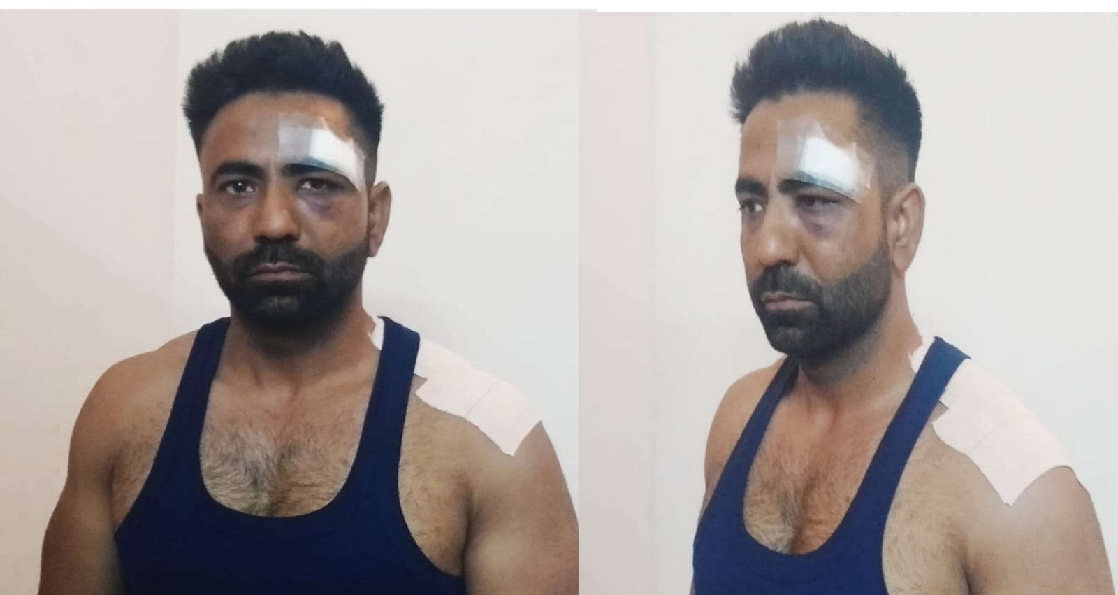 Attack on Sunil, the head of the "Media House" association, fury among the journalists of the city
