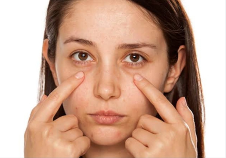 How to get rid of the problem of dark circles under the eyes?