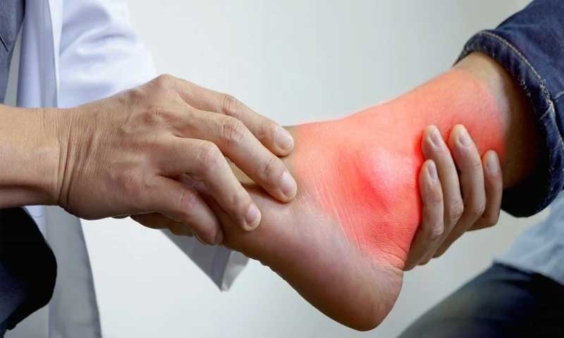 यूरिक एसिड से हैं परेशान? इन टिप्स को आजमाए