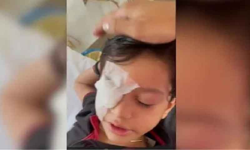 डॉक्टर की बड़ी लापरवाही, बाईं की जगह दाईं आंख का कर दिया ऑपरेशन