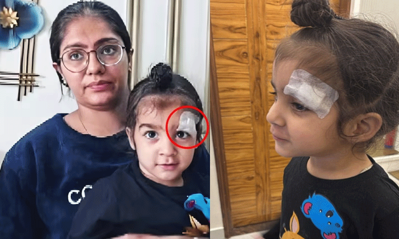 डॉक्टर की  बड़ी लापरवाही : बच्चे को लगी चोट में टांके लगाने की जगह भर दिया Feviquik