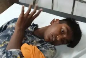 Read more about the article पिटबुल डॉग ने युवक पर हमला कर कान नोंच डाला, पिता ने हिम्मत कर बेटे को उसके चंगुल से छुड़ाया