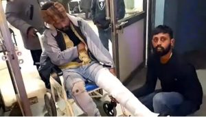 Read more about the article घर की छत पर नए साल की पार्टी कर रहे युवक को पड़ोसियों ने दिया धक्का , टांग-कंधे की टूटी हड्डी