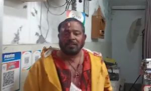 Read more about the article जालन्धर : वरिष्ठ पत्रकार व पंजाब प्रेस क्लब के सीनियर उपप्रधान राजेश थापा पर कातिलाना हमला